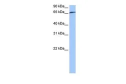 Anti-RABGGTA antibody, N-term used in Western Blot (WB). GTX46117
