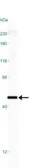 Anti-p73 antibody [5B429] used in Western Blot (WB). GTX46123