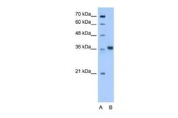 Anti-AASDHPPT antibody, C-term used in Western Blot (WB). GTX46193