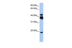 Anti-STK38 antibody, C-term used in Western Blot (WB). GTX46199