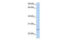 Anti-RABL4 antibody, C-term used in Western Blot (WB). GTX46248