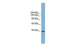 Anti-Matriptase / ST14 antibody used in Western Blot (WB). GTX46263