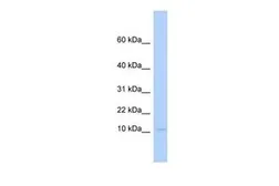 Anti-PLAC9 antibody, Internal used in Western Blot (WB). GTX46275