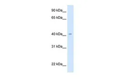 Anti-CAD antibody, Internal used in Western Blot (WB). GTX46288