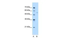 Anti-MLSTD1 antibody, C-term used in Western Blot (WB). GTX46305