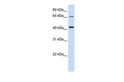 Anti-QPCTL antibody, Internal used in Western Blot (WB). GTX46328