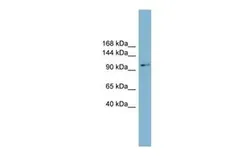 Anti-CNNM2 antibody, Internal used in Western Blot (WB). GTX46329