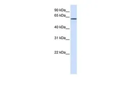 Anti-FAM20A antibody, N-term used in Western Blot (WB). GTX46330