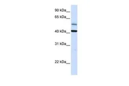 Anti-ARMCX1 antibody, C-term used in Western Blot (WB). GTX46334
