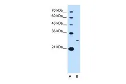 Anti-TSPAN15 antibody, C-term used in Western Blot (WB). GTX46388