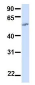 Anti-BTN2A1 antibody, N-term used in Western Blot (WB). GTX46400