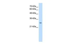 Anti-EBP antibody, N-term used in Western Blot (WB). GTX46411