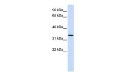 Anti-Wnt6 antibody, Internal used in Western Blot (WB). GTX46413