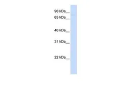Anti-CDH12 antibody, Internal used in Western Blot (WB). GTX46448