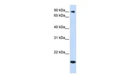 Anti-TSR1 antibody, Internal used in Western Blot (WB). GTX46464