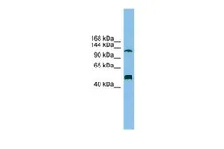Anti-GART antibody, Internal used in Western Blot (WB). GTX46531
