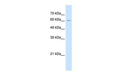 Anti-ZP2 antibody, C-term used in Western Blot (WB). GTX46550