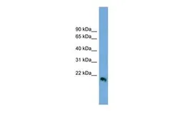 Anti-Interferon beta antibody, Internal used in Western Blot (WB). GTX46567