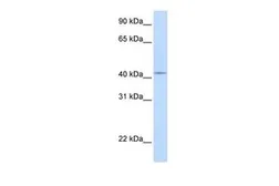 Anti-COX10 antibody, Internal used in Western Blot (WB). GTX46576