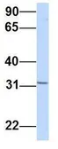 Anti-YIF1B antibody, Internal used in Western Blot (WB). GTX46602