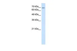 Anti-USP48 antibody, C-term used in Western Blot (WB). GTX46627