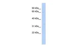 Anti-SC5DL antibody, N-term used in Western Blot (WB). GTX46640