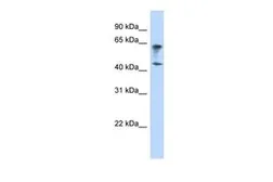 Anti-IGSF11 antibody, Internal used in Western Blot (WB). GTX46653