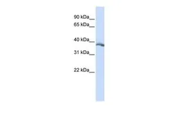 Anti-EDA antibody, Internal used in Western Blot (WB). GTX46696