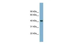 Anti-B4GALT2 antibody, Internal used in Western Blot (WB). GTX46703