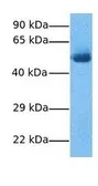 Anti-GPNMB antibody, N-term used in Western Blot (WB). GTX46707