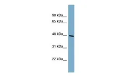 Anti-ST8SIA6 antibody, Internal used in Western Blot (WB). GTX46710