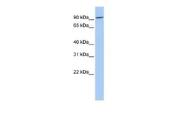 Anti-OCA2 antibody, Internal used in Western Blot (WB). GTX46746