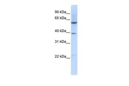 Anti-SLC35F3 antibody, Internal used in Western Blot (WB). GTX46761