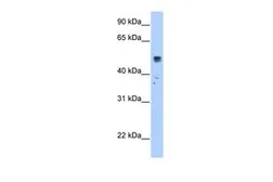 Anti-SLC35F5 antibody, C-term used in Western Blot (WB). GTX46791