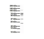 Anti-SLC27A3 antibody, Internal used in Western Blot (WB). GTX46793