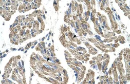 Anti-SLC25A38 antibody, Internal used in IHC (Paraffin sections) (IHC-P). GTX46811