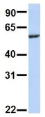 Anti-SLC33A1 antibody, Internal used in Western Blot (WB). GTX46828