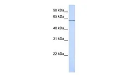 Anti-EAAT3 antibody, N-term used in Western Blot (WB). GTX46835