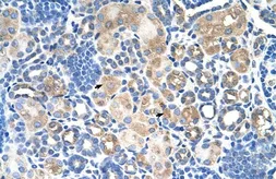 Anti-SLC38A1 antibody, Internal used in IHC (Paraffin sections) (IHC-P). GTX46848
