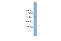 Anti-SLC12A3 antibody, C-term used in Western Blot (WB). GTX46863