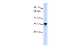 Anti-RNF182 antibody, N-term used in Western Blot (WB). GTX46883