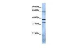 Anti-PCGF5 antibody, N-term used in Western Blot (WB). GTX46899