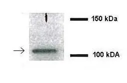 Anti-NEDD4L antibody, Internal used in Western Blot (WB). GTX46924