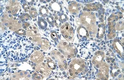 Anti-FBXO25 antibody, C-term used in IHC (Paraffin sections) (IHC-P). GTX46929