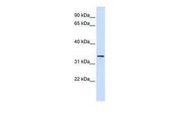 Anti-FBXO25 antibody, N-term used in Western Blot (WB). GTX46930