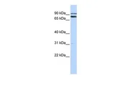 Anti-TRIM67 antibody, C-term used in Western Blot (WB). GTX46943