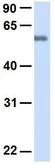 Anti-SLC19A3 antibody, Internal used in Western Blot (WB). GTX46980