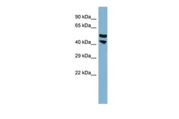 Anti-Protor-2 antibody, Internal used in Western Blot (WB). GTX46987