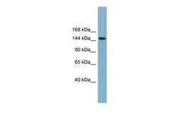 Anti-KIAA1199 antibody, Internal used in Western Blot (WB). GTX47001