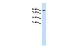 Anti-EPS8L1 antibody, N-term used in Western Blot (WB). GTX47009